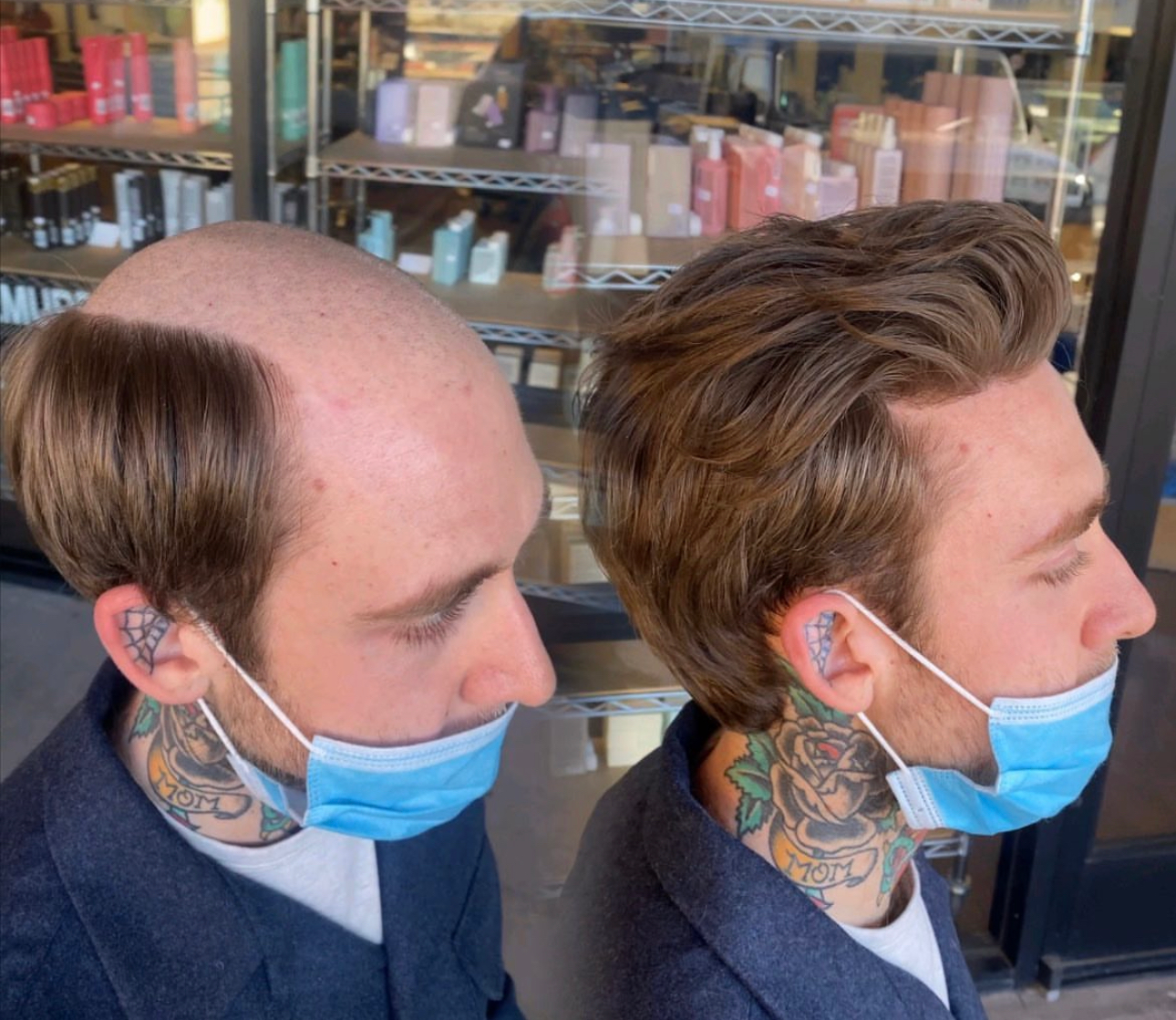 Hair system consultation step in Alpharetta, Georgia
