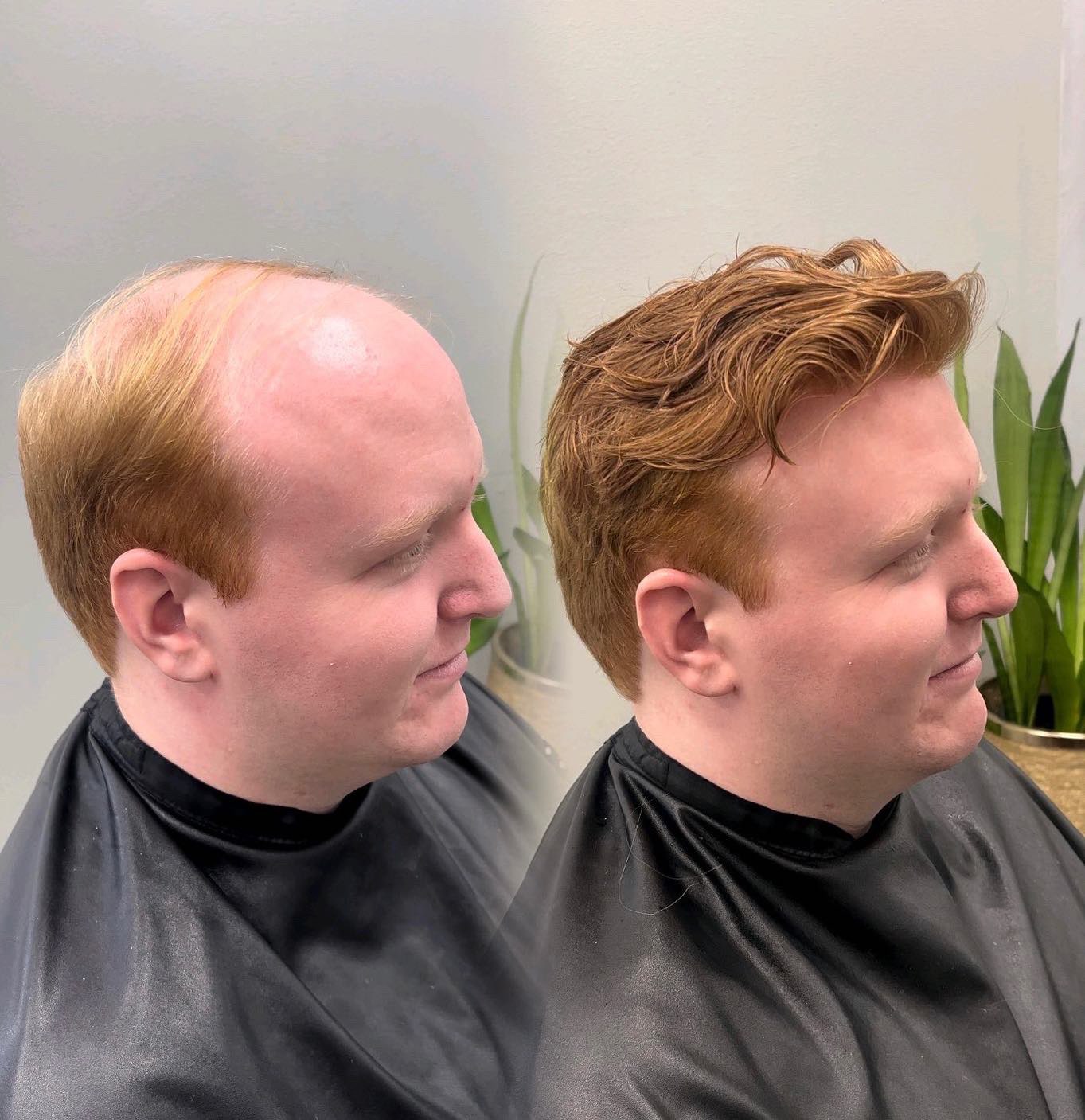 Non-surgical hair system inspiration for Alpharetta, Georgia